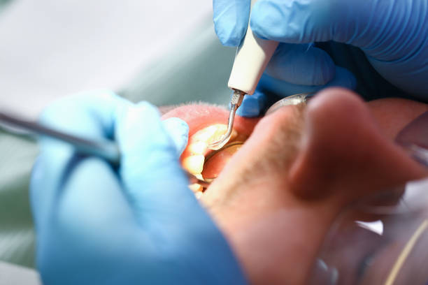 Best Emergency Treatment for Dental Infections or Abscesses in Oakwood, PA